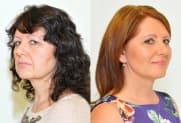 Facelift Galerie