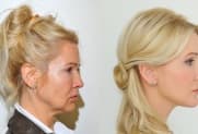 Facelift Galerie