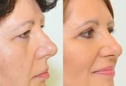Facelift Galerie