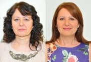 Facelift Galerie