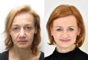 Facelift Galerie
