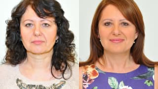 Foto – Facelift, Necklift, Augenliderkorrektur – Alena