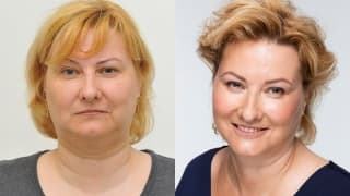 Foto – Doppelkinn – Dagmar