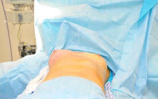 Autoaugmentation der Brust