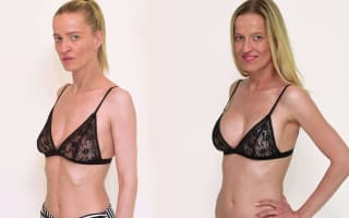 Brustmodellierung