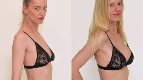 Brustmodellierung