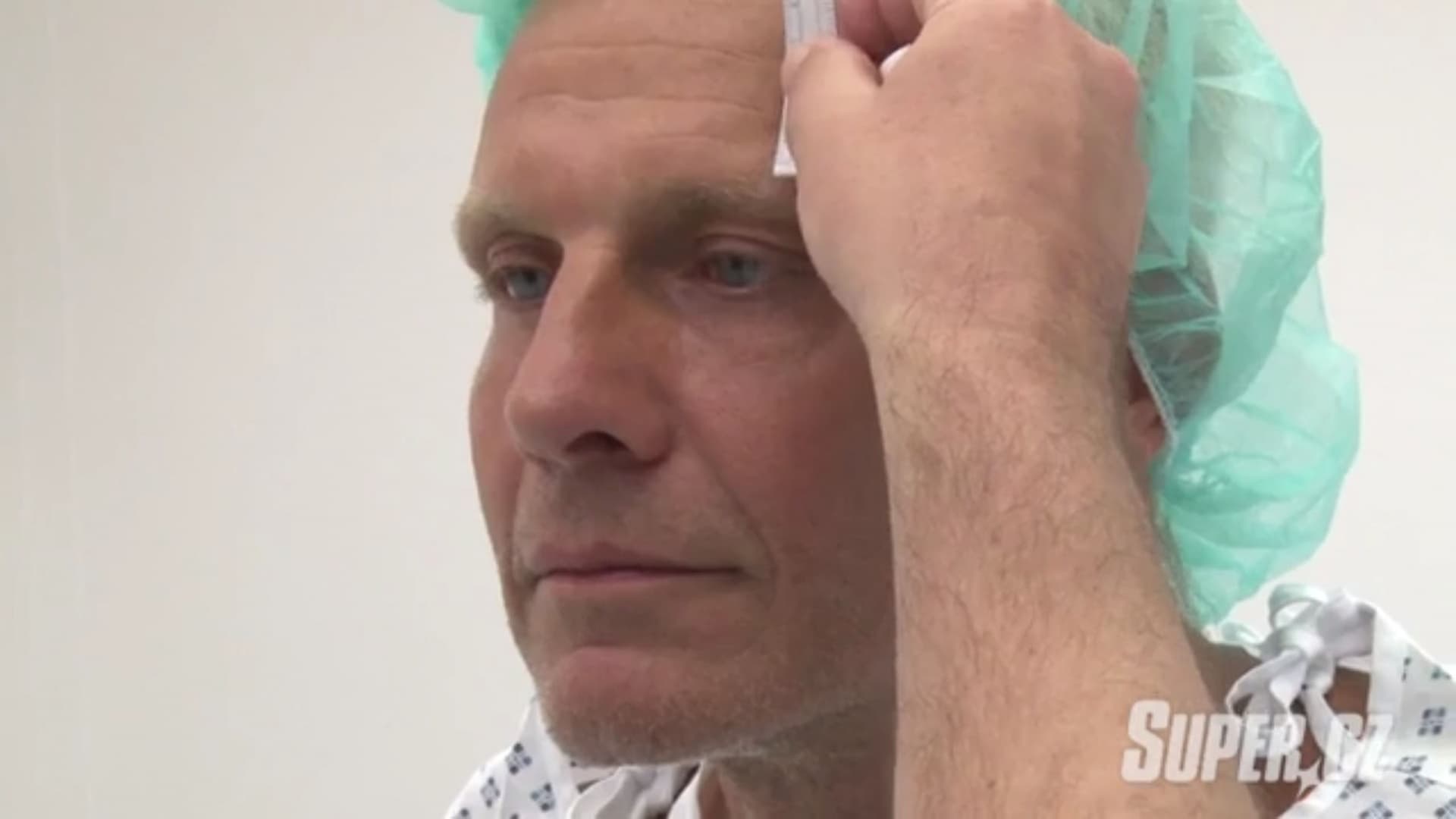 Martin Maxa na korekcii očných viečok - Klinika YES VISAGE