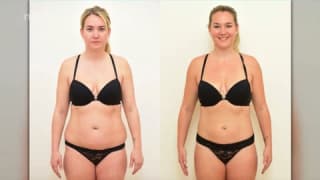 Video - Laser-Fettabsaugung SlimLipo - Tereza